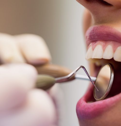 Close-up of dentist examining a female patient with tools at dental clinic