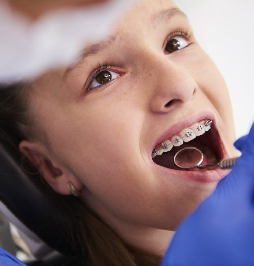 Girl with braces during a routine, dental examination