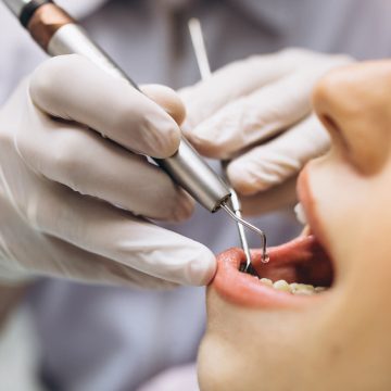 Woman patient at dentist